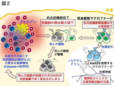 精神的ストレスがアトピー性皮膚炎を悪化させるメカニズムを解明 